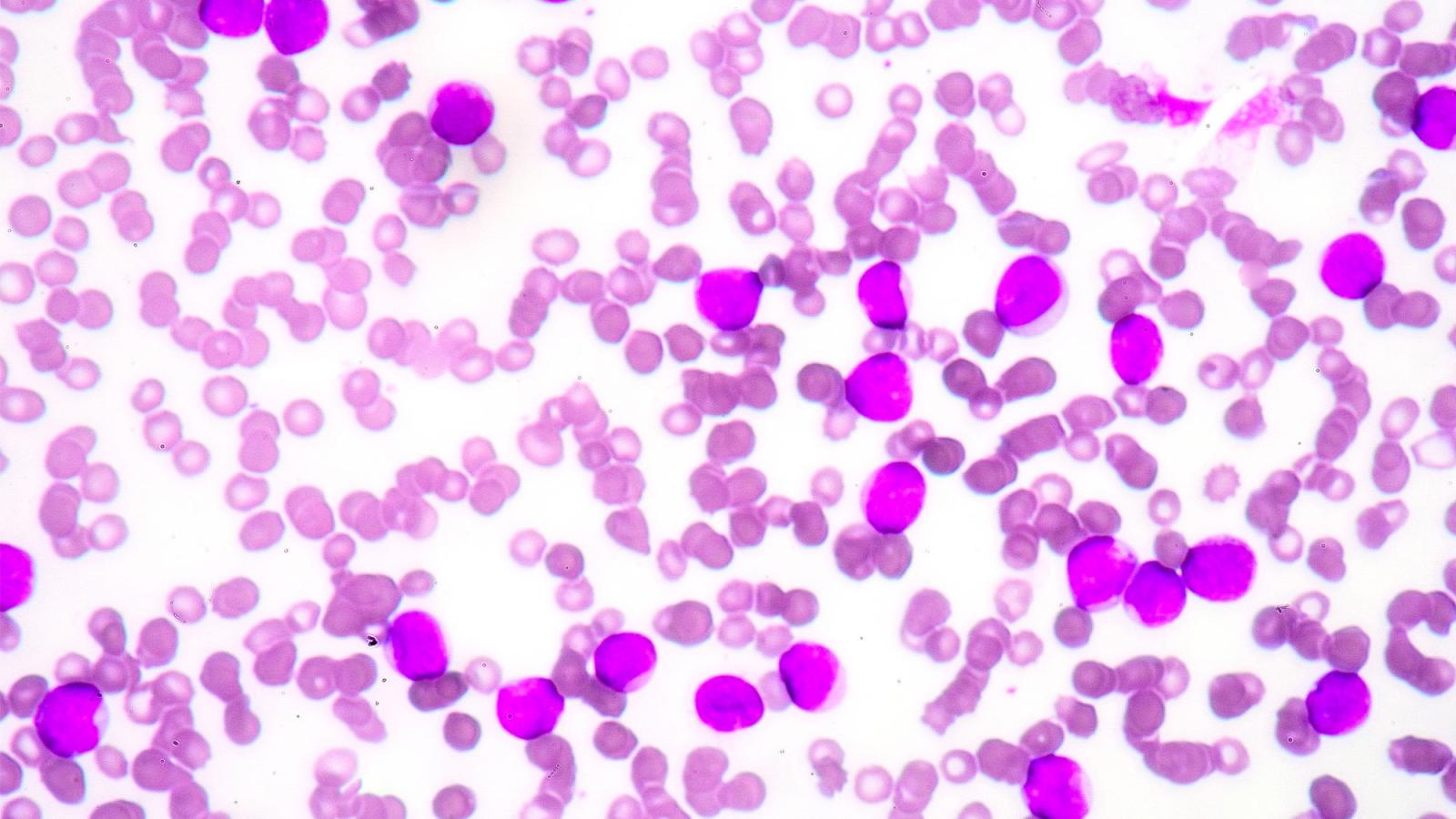 extreme close up of bone marrow cells. 